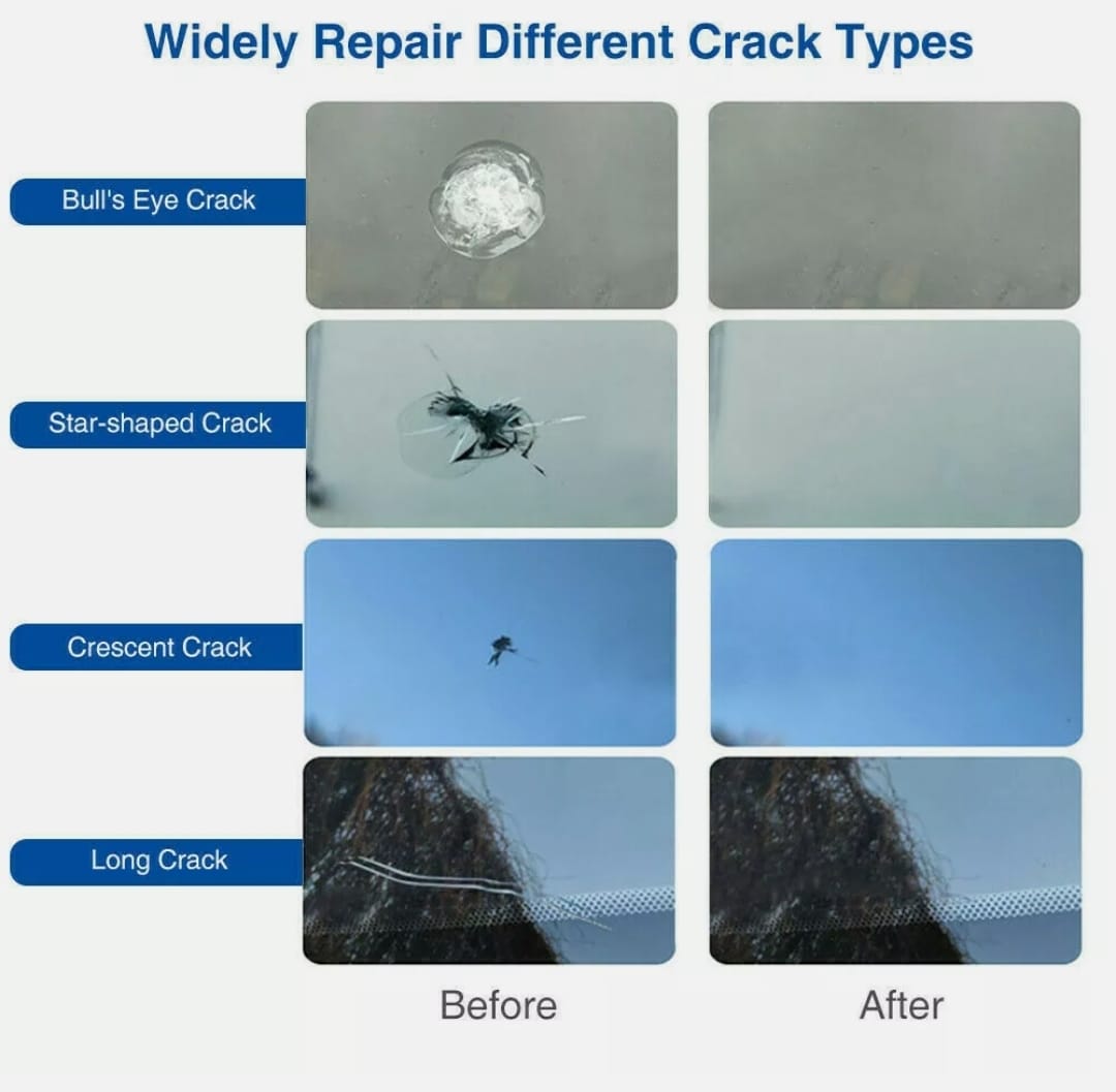 Windshield Repair Resin Kit with 5 Bottles for Auto Glass