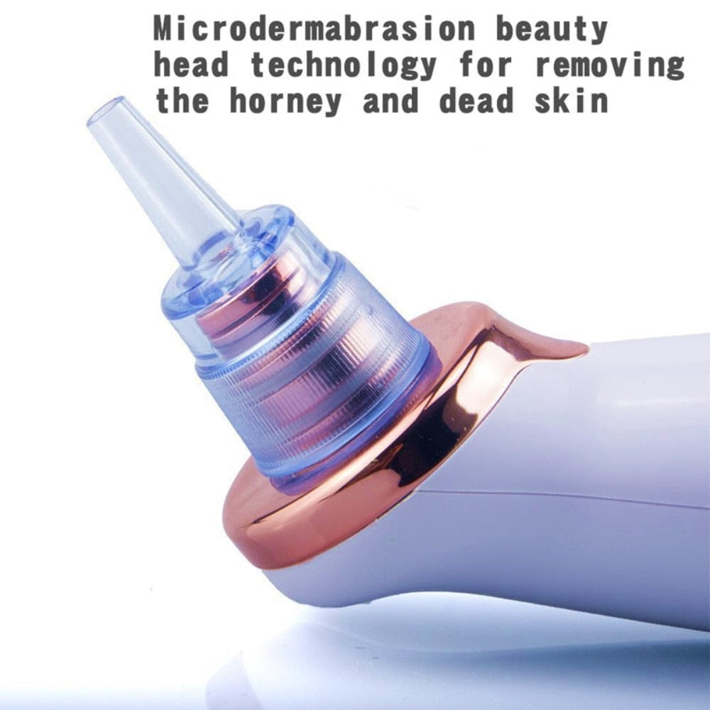 Electric Vacuum Blackhead Remover Device