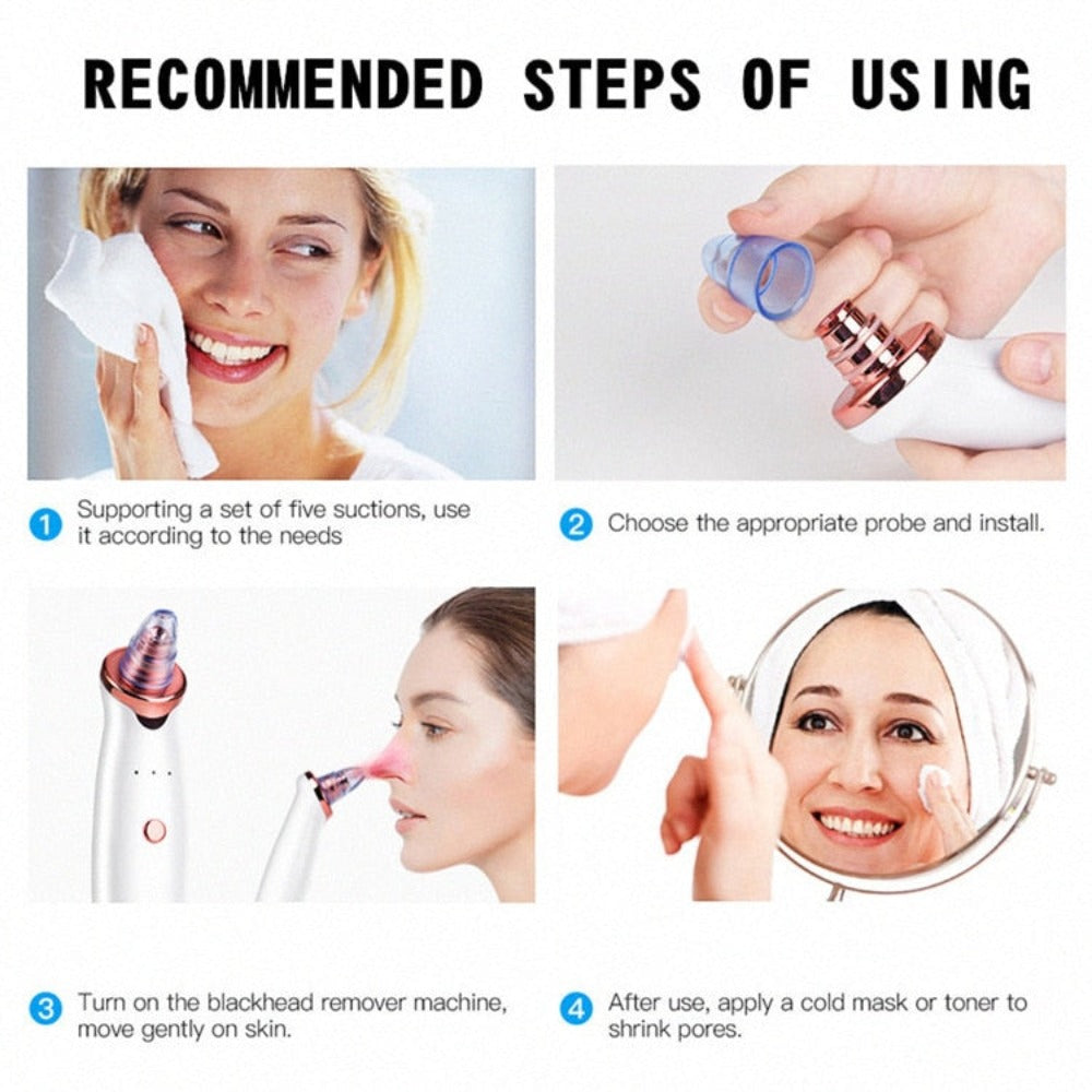 Electric Vacuum Blackhead Remover Device